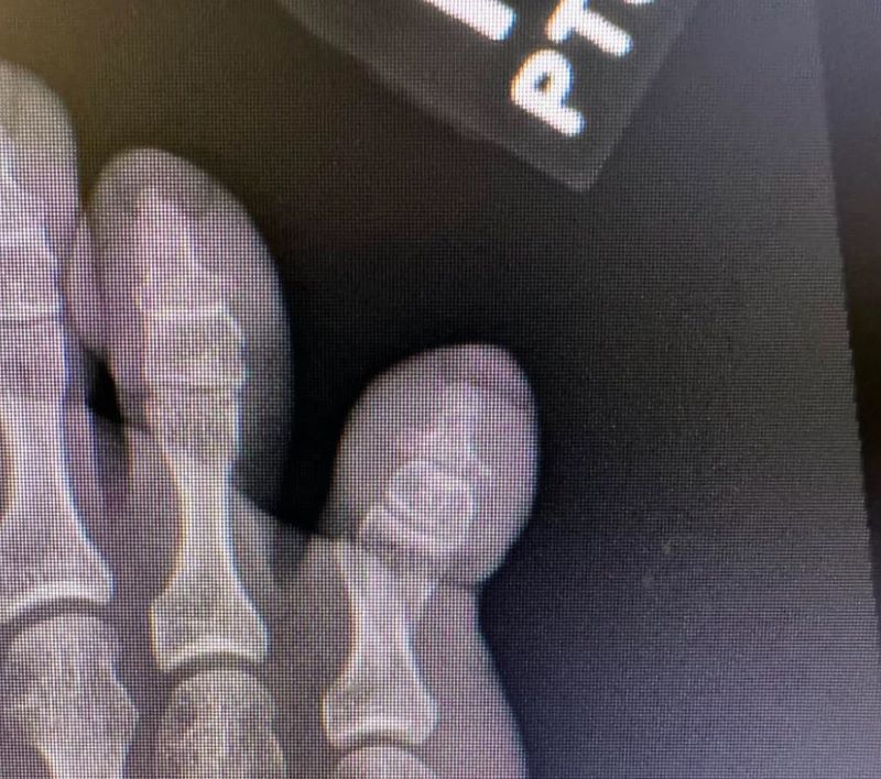 Tweemaal pech - Blog