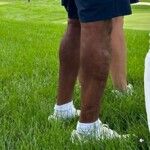 Het rechterbeen van Tiger Woods